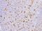 Matrix metalloproteinase-9 antibody, 10327-T08, Sino Biological, Immunohistochemistry paraffin image 