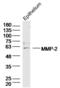 Matrix Metallopeptidase 2 antibody, orb101049, Biorbyt, Western Blot image 