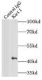 Potassium Voltage-Gated Channel Subfamily J Member 10 antibody, FNab04585, FineTest, Immunoprecipitation image 