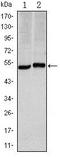 Carbonic Anhydrase 9 antibody, TA336805, Origene, Western Blot image 