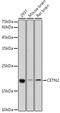 Centrin 2 antibody, GTX53956, GeneTex, Western Blot image 