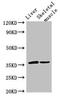 Lymphatic Vessel Endothelial Hyaluronan Receptor 1 antibody, orb52318, Biorbyt, Western Blot image 