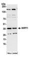 WAS/WASL Interacting Protein Family Member 1 antibody, A305-377A, Bethyl Labs, Western Blot image 