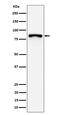 Membrane Spanning 4-Domains A14 antibody, M15744, Boster Biological Technology, Western Blot image 