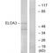 Elongin A3 antibody, A14654, Boster Biological Technology, Western Blot image 