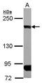 CAP-Gly Domain Containing Linker Protein 1 antibody, GTX117504, GeneTex, Western Blot image 