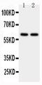 Cytochrome P450 Family 11 Subfamily A Member 1 antibody, PA5-79123, Invitrogen Antibodies, Western Blot image 