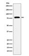 RNA polymerase II-associated factor 1 homolog antibody, M01640, Boster Biological Technology, Western Blot image 