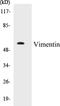 Vimentin antibody, EKC1595, Boster Biological Technology, Western Blot image 