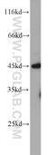 Putative disintegrin and metalloproteinase domain-containing protein 5 antibody, 22147-1-AP, Proteintech Group, Western Blot image 