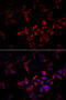 Natural Cytotoxicity Triggering Receptor 3 antibody, MBS9126234, MyBioSource, Immunofluorescence image 