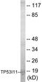 Tumor Protein P53 Inducible Protein 11 antibody, EKC1621, Boster Biological Technology, Western Blot image 