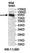 Anoctamin 9 antibody, orb78297, Biorbyt, Western Blot image 