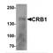 Crumbs Cell Polarity Complex Component 1 antibody, MBS153460, MyBioSource, Western Blot image 