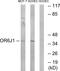 Olfactory Receptor Family 6 Subfamily J Member 1 (Gene/Pseudogene) antibody, PA5-39857, Invitrogen Antibodies, Western Blot image 