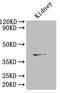 Renin-2 antibody, A53129-100, Epigentek, Western Blot image 