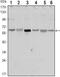 Serine/Threonine Kinase 11 antibody, MA5-15729, Invitrogen Antibodies, Western Blot image 