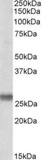 Synaptosomal-associated protein 23 antibody, GTX88021, GeneTex, Western Blot image 