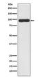 Seprase antibody, M00422, Boster Biological Technology, Western Blot image 