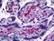 Stromelysin-3 antibody, LS-B5662, Lifespan Biosciences, Immunohistochemistry frozen image 