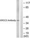 DNA repair protein XRCC3 antibody, TA312228, Origene, Western Blot image 