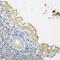 Ceroid-lipofuscinosis neuronal protein 5 antibody, GTX66133, GeneTex, Immunohistochemistry paraffin image 
