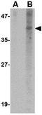 Nanos C2HC-Type Zinc Finger 1 antibody, GTX17009, GeneTex, Western Blot image 