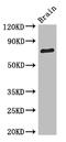 Synaptic Vesicle Glycoprotein 2B antibody, A61210-100, Epigentek, Western Blot image 