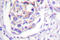 Insulin Receptor Substrate 1 antibody, AP06432PU-N, Origene, Immunohistochemistry paraffin image 