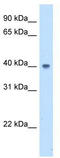 Abhydrolase Domain Containing 5 antibody, TA344119, Origene, Western Blot image 