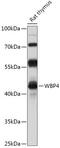 WW Domain Binding Protein 4 antibody, 18-015, ProSci, Western Blot image 