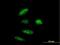 RNA 3'-Terminal Phosphate Cyclase antibody, H00008634-B01P, Novus Biologicals, Immunocytochemistry image 