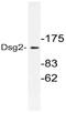 Desmoglein 2 antibody, AP21161PU-N, Origene, Western Blot image 