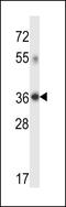 Dehydrogenase/Reductase 7C antibody, LS-C167403, Lifespan Biosciences, Western Blot image 