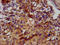 Fukutin Related Protein antibody, LS-C672951, Lifespan Biosciences, Immunohistochemistry paraffin image 