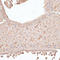 Protein CIP2A antibody, LS-C747413, Lifespan Biosciences, Immunohistochemistry paraffin image 