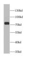 Anthrax toxin receptor 2 antibody, FNab00451, FineTest, Western Blot image 