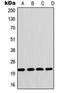 Glycoprotein Ib Platelet Subunit Beta antibody, orb213989, Biorbyt, Western Blot image 