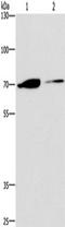 Peroxisomal carnitine O-octanoyltransferase antibody, TA349832, Origene, Western Blot image 