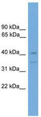Forkhead Box Q1 antibody, TA341770, Origene, Western Blot image 