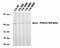 Protein Phosphatase 2 Regulatory Subunit B'Delta antibody, orb76779, Biorbyt, Western Blot image 