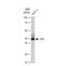 Tissue Factor Pathway Inhibitor antibody, GTX02843, GeneTex, Western Blot image 