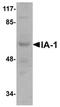 INSM Transcriptional Repressor 1 antibody, orb75283, Biorbyt, Western Blot image 