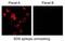 Carbonic Anhydrase 9 antibody, GTX15086, GeneTex, Immunofluorescence image 