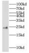 Nucleoside diphosphate kinase homolog 5 antibody, FNab05765, FineTest, Western Blot image 