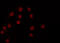 5'-3' Exoribonuclease 2 antibody, GTX01072, GeneTex, Immunofluorescence image 