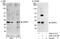 Zinc And Ring Finger 2 antibody, A302-312A, Bethyl Labs, Western Blot image 