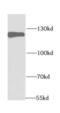 Huntingtin-interacting protein 1 antibody, FNab03867, FineTest, Western Blot image 