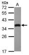 Sulfotransferase Family 1A Member 3 antibody, GTX101675, GeneTex, Western Blot image 