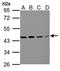 Branched Chain Amino Acid Transaminase 2 antibody, TA307893, Origene, Western Blot image 